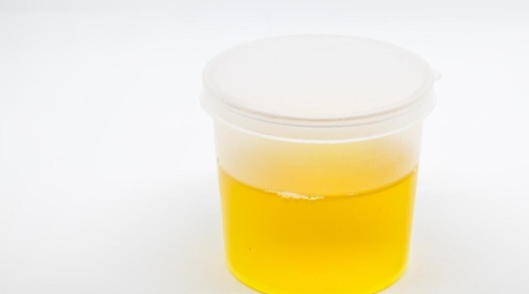 Managing UTIs in aged care