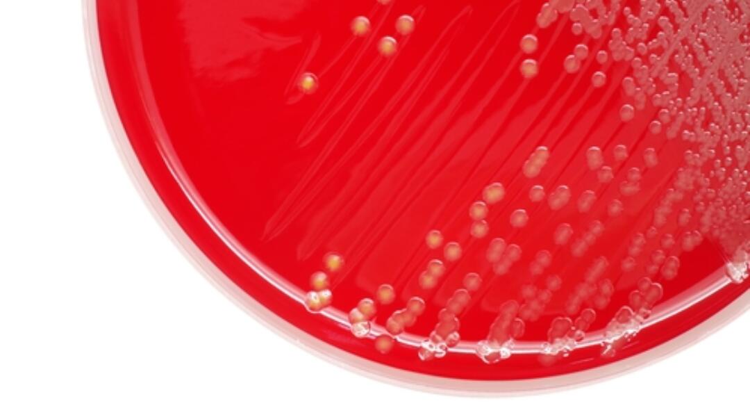 Antimicrobials: bacteraemia