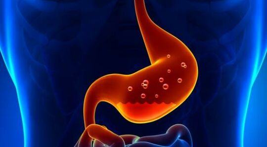 Managing GORD with PPIs in primary care 