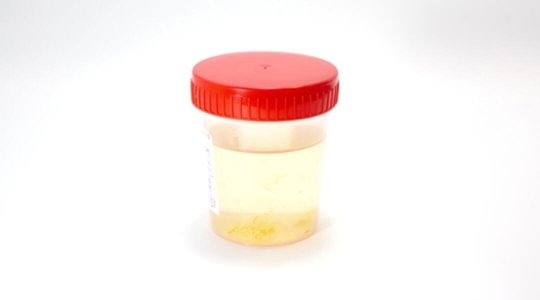 Urinary tract infections