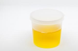 Managing UTIs in aged care