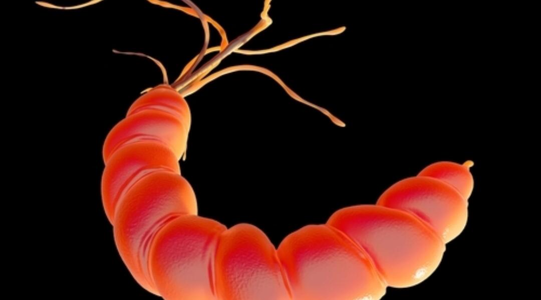 Peptic ulceration with H. pylori