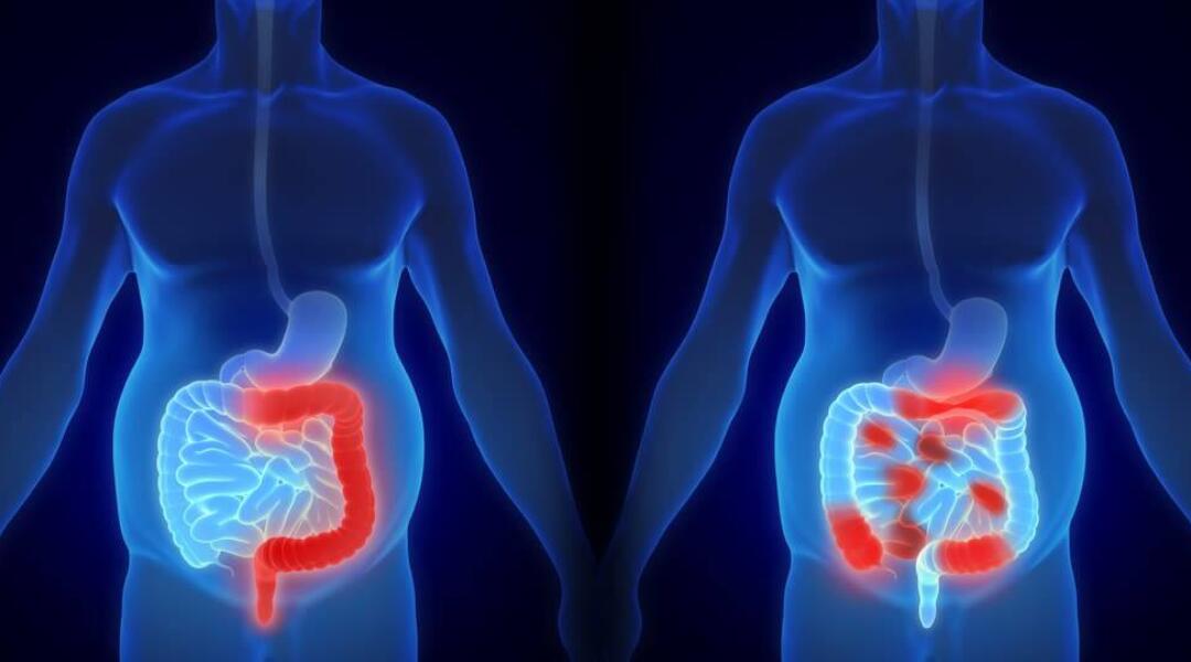 B DMARDs-Gastro-webinar-Hero