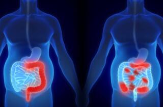 B DMARDs-Gastro-webinar-Hero