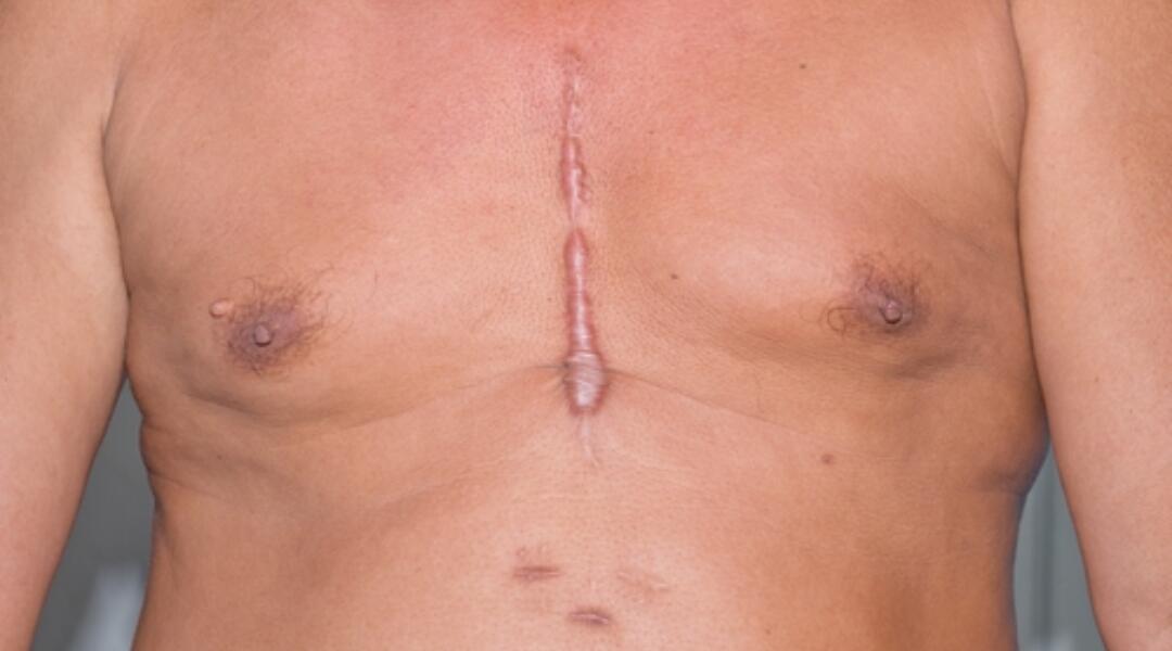 How to manage warfarin therapy