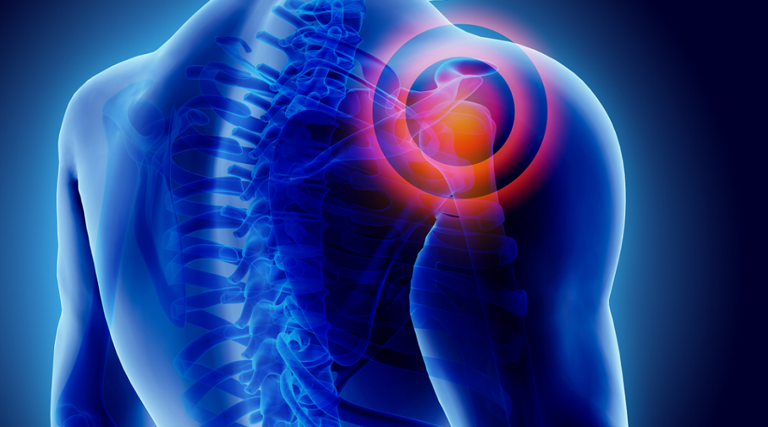 Non-traumatic shoulder pain in general practice: a pragmatic approach to diagnosis