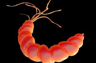 Peptic ulceration with H. pylori