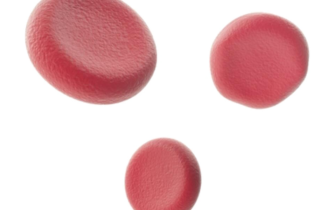 8db8acdbdd9881fd-904f50e6a5c5-251695_npc_anaemia20170407-76353-khr4en