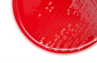 Antimicrobials: bacteraemia