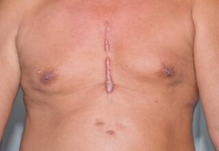 How to manage warfarin therapy