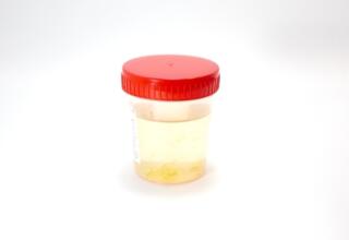 Urinary tract infections