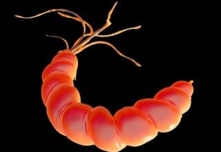 Peptic ulceration with H. pylori