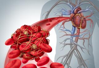 Long-term prescribing of new oral anticoagulants