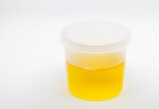 Managing UTIs in aged care