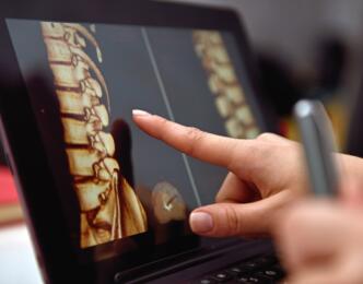 Bone Health Action Plan