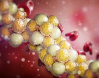 Statins Patient Action Plan for assessing and managing muscle symptoms