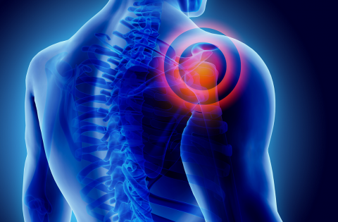 Non-traumatic shoulder pain in general practice: a pragmatic approach to diagnosis