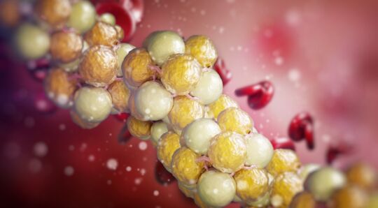Managing lipids