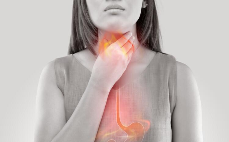 Managing reflux and heartburn